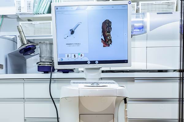 マウスピースの型取り