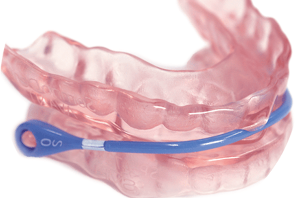 マウスピースの写真