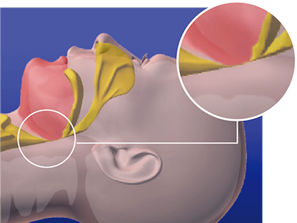 呼吸が詰まっている時の写真