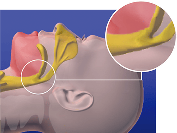 呼吸が詰まっている時の写真
